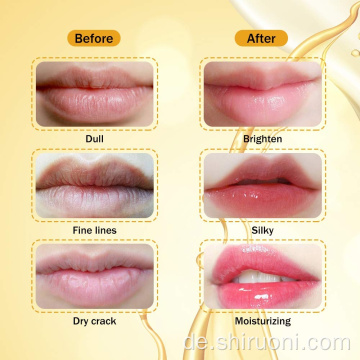 24 Karat Gold Lippenmaskenfalten-Patches